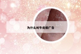 為什么叫牛皮癬廣告