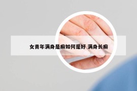 女青年滿身是癬如何是好 滿身長癬