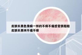 皮膚長(zhǎng)黑色像癬一樣的不癢不痛感覺很粗糙 皮膚長(zhǎng)黑塊不痛不癢