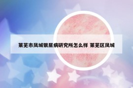 萊蕪市鳳城銀屑病研究所怎么樣 萊蕪區(qū)鳳城