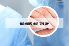云朵癬圖片 云朵 百度百科