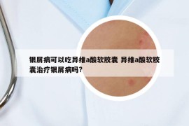 銀屑病可以吃異維a酸軟膠囊 異維a酸軟膠囊治療銀屑病嗎?