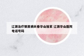 遼源治療銀屑病長春華山獨家 遼源華山醫(yī)院電話號碼