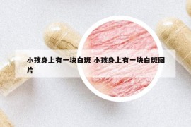 小孩身上有一塊白斑 小孩身上有一塊白斑圖片