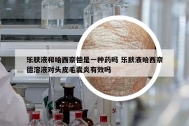 樂膚液和哈西奈德是一種藥嗎 樂膚液哈西奈德溶液對頭皮毛囊炎有效嗎