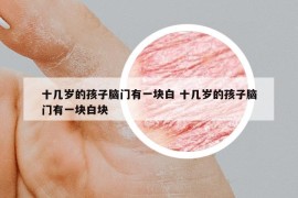 十幾歲的孩子腦門有一塊白 十幾歲的孩子腦門有一塊白塊