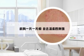 前胸一片一片癬 自古溫柔勝剛強(qiáng)