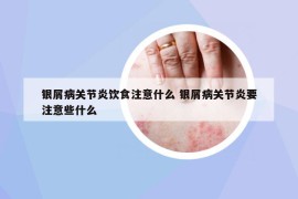 銀屑病關(guān)節(jié)炎飲食注意什么 銀屑病關(guān)節(jié)炎要注意些什么