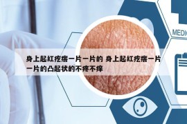身上起紅疙瘩一片一片的 身上起紅疙瘩一片一片的凸起狀的不疼不癢
