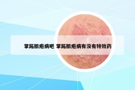 掌跖膿皰病吧 掌跖膿皰病有沒(méi)有特效藥