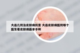 大連幾院治皮膚病厲害 大連皮膚病醫(yī)院哪個醫(yī)生看皮膚病最拿手啊