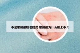 不是銀屑病臉老脫皮 銀屑病為什么臉上不長