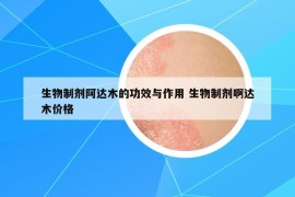 生物制劑阿達木的功效與作用 生物制劑啊達木價格