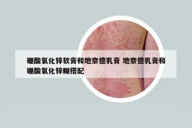 硼酸氧化鋅軟膏和地奈德乳膏 地奈德乳膏和硼酸氧化鋅糊搭配