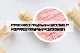 農村里有哪些野生新鮮雜草可治皮膚癬病 農村里有哪些野生新鮮雜草可治皮膚癬病的