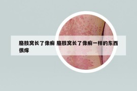 胳肢窩長(zhǎng)了像癬 胳肢窩長(zhǎng)了像癬一樣的東西很癢