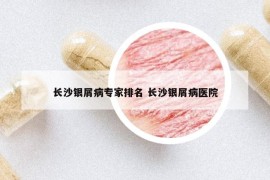 長沙銀屑病專家排名 長沙銀屑病醫(yī)院