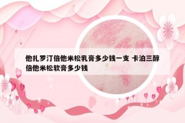 他扎羅汀倍他米松乳膏多少錢一支 卡泊三醇倍他米松軟膏多少錢