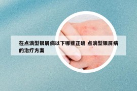 在點滴型銀屑病以下哪些正確 點滴型銀屑病的治療方案