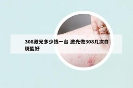 308激光多少錢一臺 激光做308幾次白斑能好