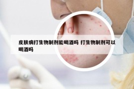 皮膚病打生物制劑能喝酒嗎 打生物制劑可以喝酒嗎