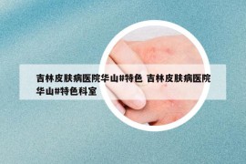 吉林皮膚病醫(yī)院華山#特色 吉林皮膚病醫(yī)院華山#特色科室