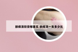 膚癢清軟膏哪里買 膚癢清一支多少元