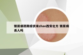 銀屑病初期癥狀來zhao西安北方 銀屑病丟人嗎