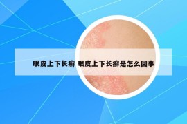 眼皮上下長癬 眼皮上下長癬是怎么回事