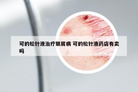 可的松針液治療銀屑病 可的松針液藥店有賣嗎