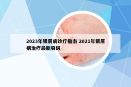 2023年銀屑病診療指南 2021年銀屑病治療最新突破