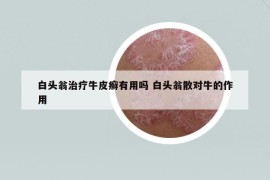 白頭翁治療牛皮癬有用嗎 白頭翁散對(duì)牛的作用