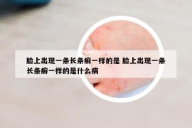 臉上出現(xiàn)一條長條癬一樣的是 臉上出現(xiàn)一條長條癬一樣的是什么病