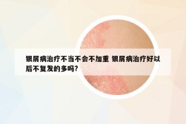 銀屑病治療不當(dāng)不會不加重 銀屑病治療好以后不復(fù)發(fā)的多嗎?