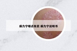 癬力寧哪點(diǎn)有賣 癬力寧說明書