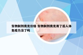 生物制劑類(lèi)克價(jià)格 生物制劑類(lèi)克用了后人體免疫力沒(méi)了嗎