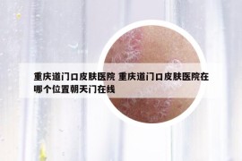重慶道門口皮膚醫(yī)院 重慶道門口皮膚醫(yī)院在哪個(gè)位置朝天門在線