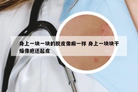 身上一塊一塊的脫皮像癬一樣 身上一塊塊干燥像疤還起皮