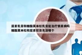 尿素乳膏和糠酸莫米松乳膏能治療銀屑病嗎 糠酸莫米松和尿素軟膏先涂哪個(gè)