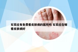 石家莊有免費(fèi)看皮膚病的醫(yī)院?jiǎn)?石家莊在哪看皮膚病好