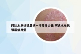 阿達木單抗銀屑病一療程多少錢 阿達木單抗銀屑病用量