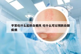平常吃什么能防白癜風(fēng) 吃什么可以預(yù)防白顛瘋病