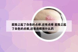 屁股上起了白色的點癬,還有點癢 屁股上起了白色的點癬,還有點癢用什么藥