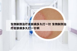 生物制劑治療皮膚病多久打一針 生物制劑治療皮膚病多久打一針啊