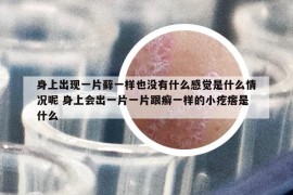 身上出現(xiàn)一片蘚一樣也沒有什么感覺是什么情況呢 身上會出一片一片跟癬一樣的小疙瘩是什么
