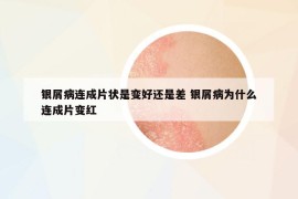 銀屑病連成片狀是變好還是差 銀屑病為什么連成片變紅
