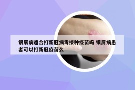 銀屑病適合打新冠病毒接種疫苗嗎 銀屑病患者可以打新冠疫苗么