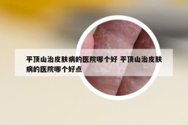 平頂山治皮膚病的醫(yī)院哪個好 平頂山治皮膚病的醫(yī)院哪個好點