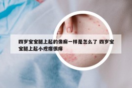 四歲寶寶腿上起的像癬一樣是怎么了 四歲寶寶腿上起小疙瘩很癢