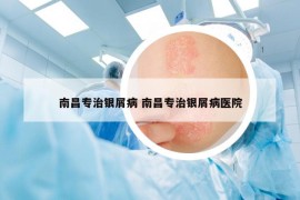 南昌專治銀屑病 南昌專治銀屑病醫(yī)院